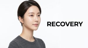 리프팅 시술 후 매끄러운 얼굴 라인을 가진 한국인 여성 모델